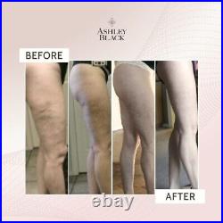 Ashley Black Savage Blaster 14 Claws FasciaBlaster Cellulite Reduction Massager