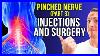Injections And Surgery Options For Pinched Nerve In Neck Cervical Radiculopathy Series Part 3